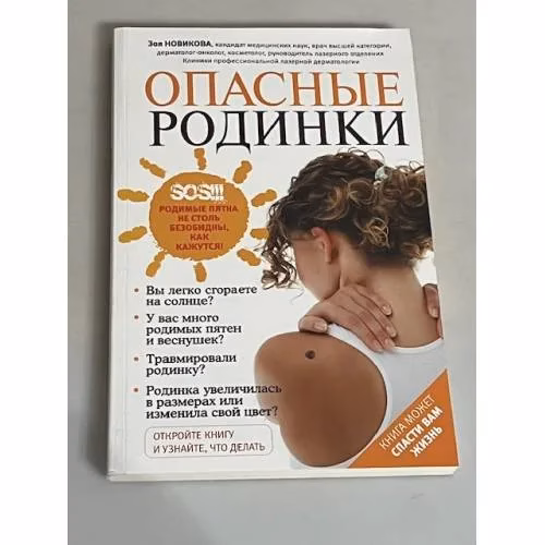 Book cover: Опасные родинки